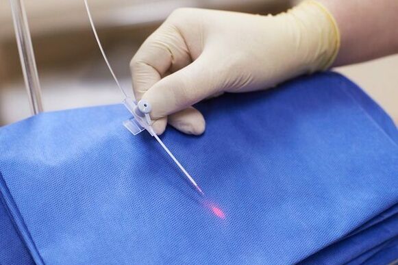 Dans certains cas, la thérapie au laser est utilisée pour traiter la prostatite chronique