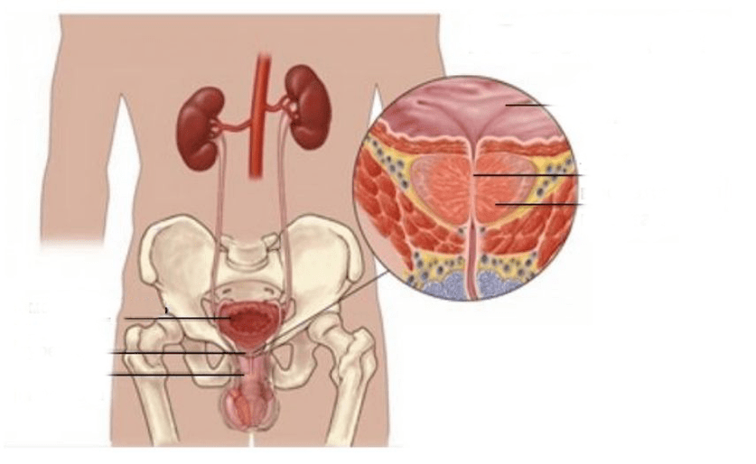 Prostatite chez les hommes