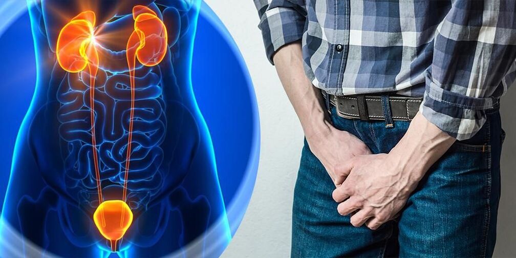 Inflammation de la prostate chez l'homme