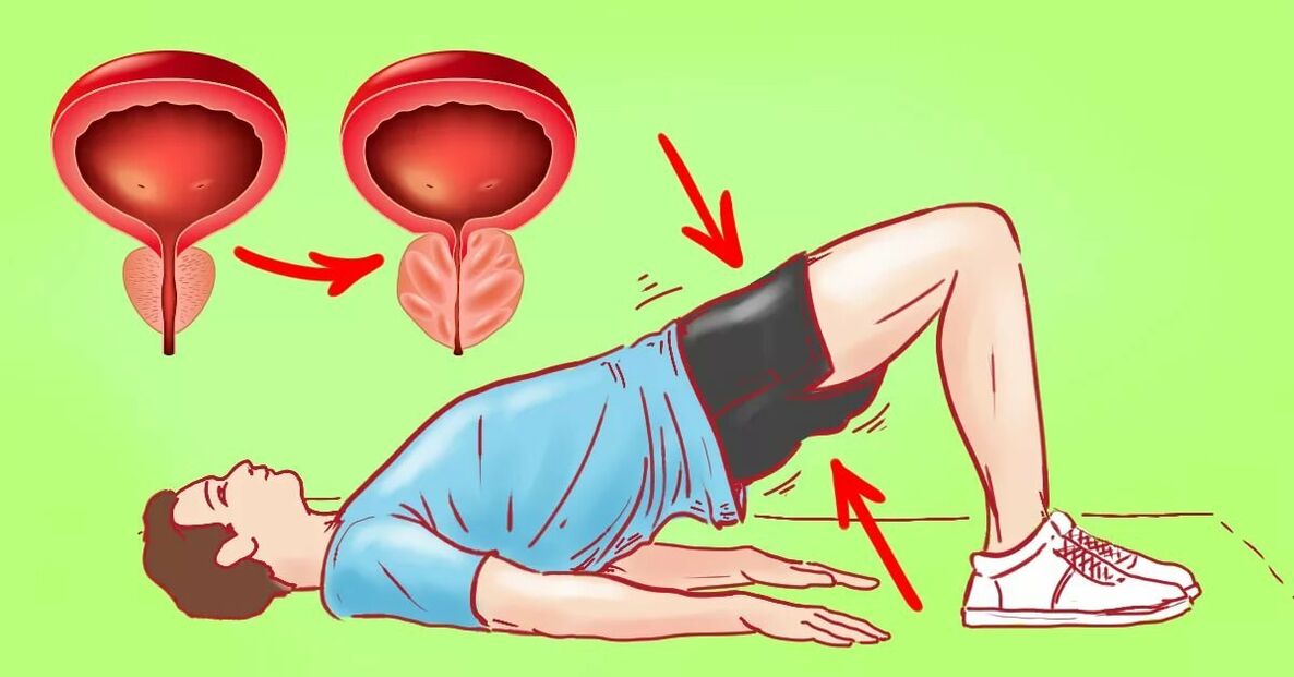 Exercices contre la prostatite